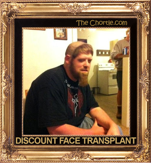 Discount face transplant