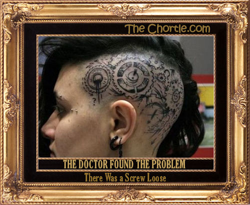 The doctor found the problem. There was a screw loose.
