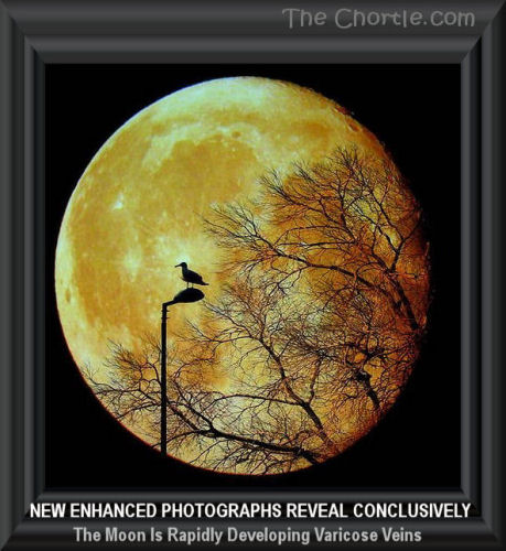 New enhanced photographs reveal conclusively the moon is rapidly developing varicose veins 