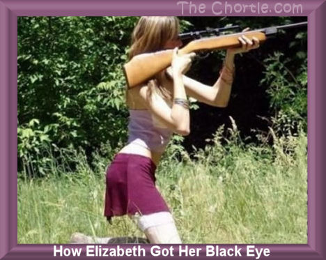 How Elizabeth got her black eye