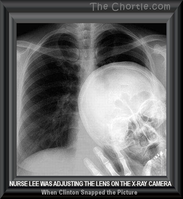 Nurse Lee was adjusting the lens on the x-ray camera when Clinton snapped the picture.