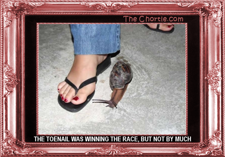 The toenail was winning the race, but not by much.