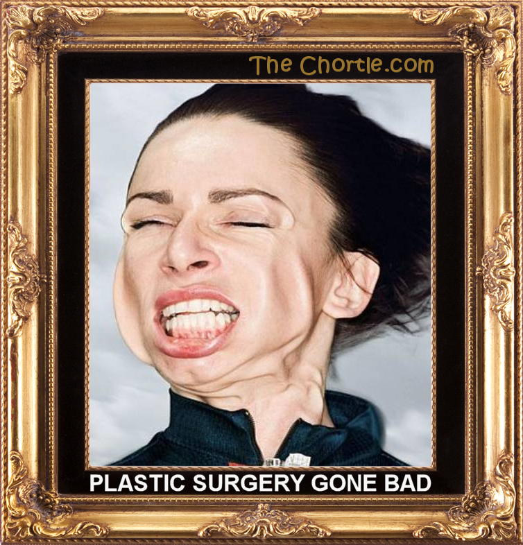 Plastic surgery gone bad