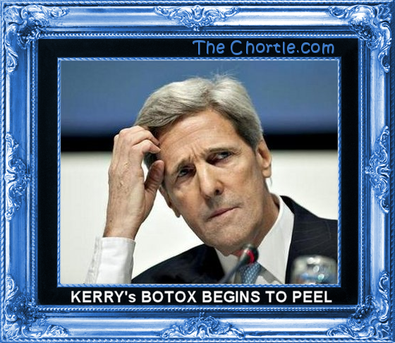Kerry's botox begins to peel.