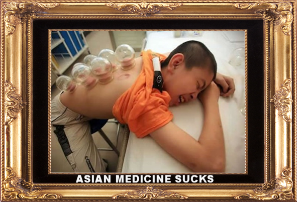 Asian medicine sucks