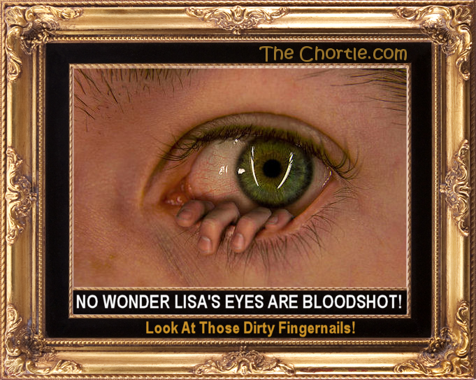 No wonder Lisa's eyes are bloodshot!  Look at those dirty fingernails!