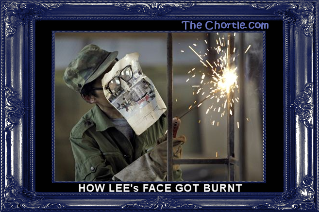 How Lee's face got burnt