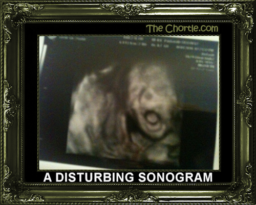 A disturbing sonogram